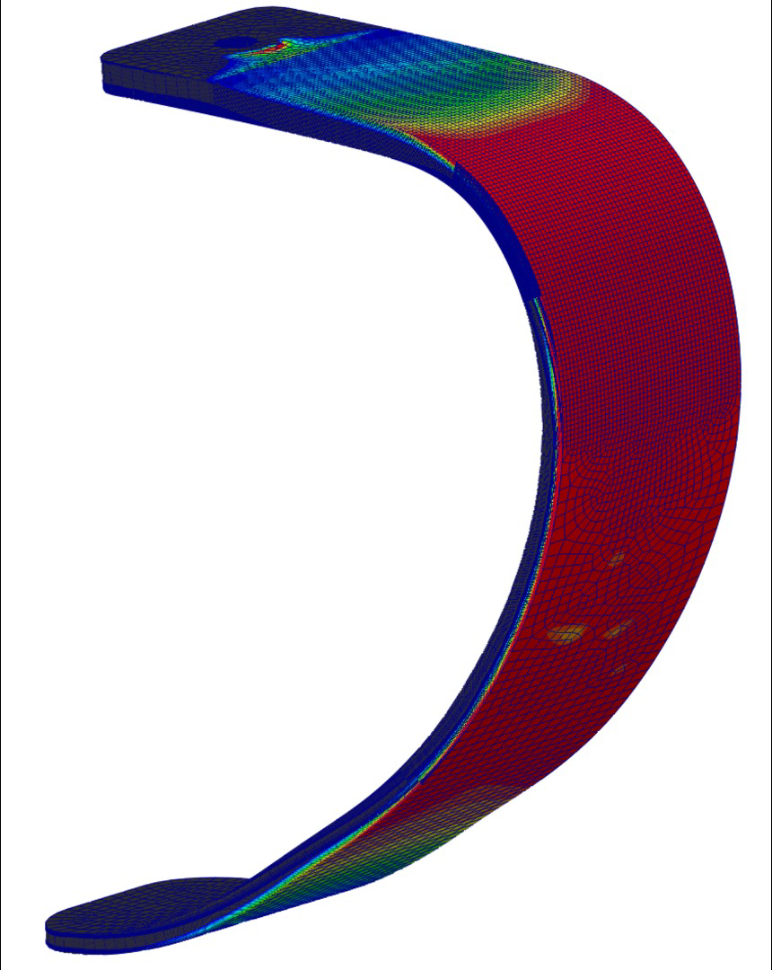 複合材料製の義足の変形解析