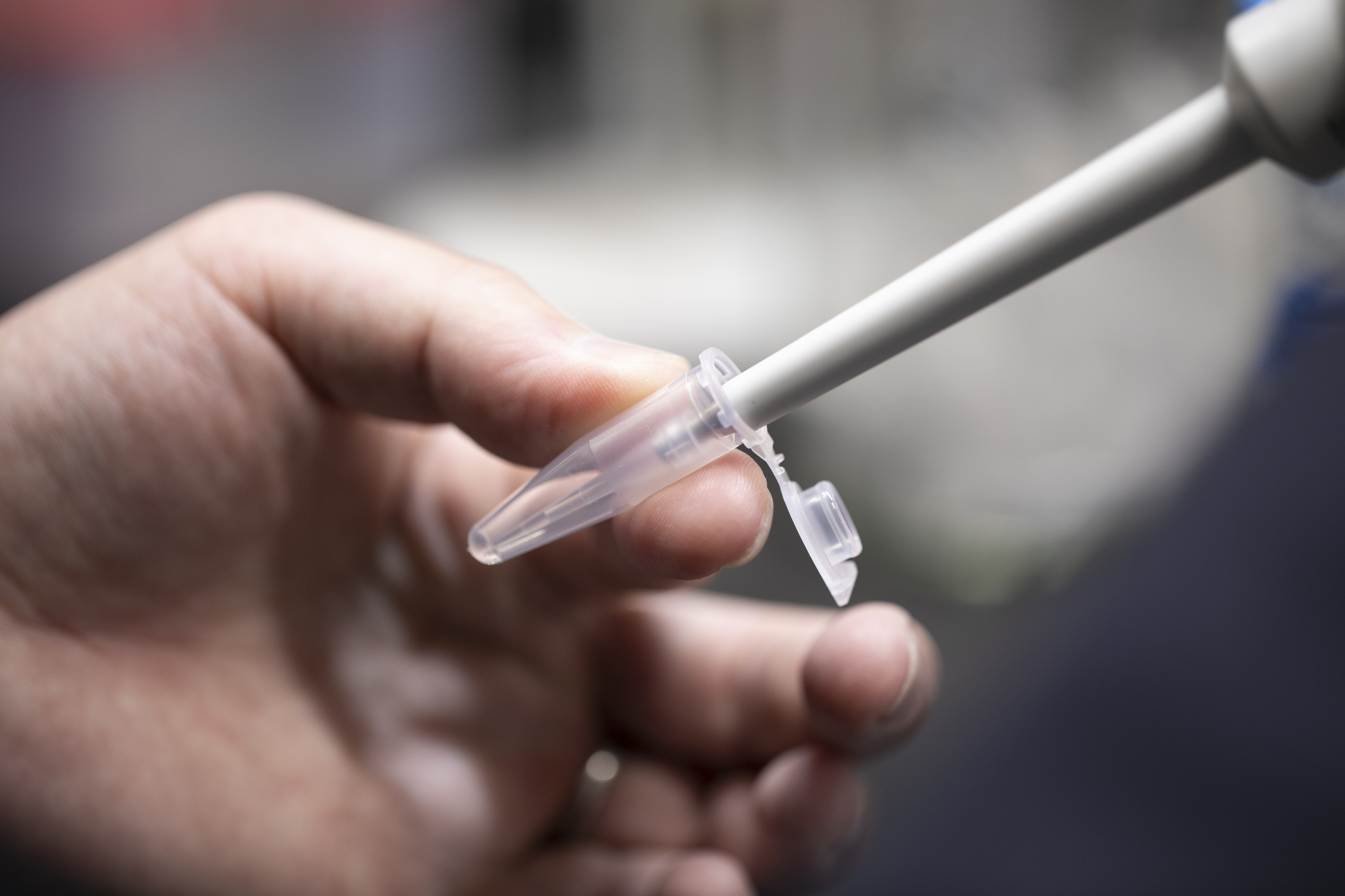 病気の原因や治療薬を見つけるためには身体の中で起こっている現象を一つ一つ検証していく必要があります。写真のピペット操作は実験でとても基本になる作業です。