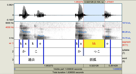 音響解析の例