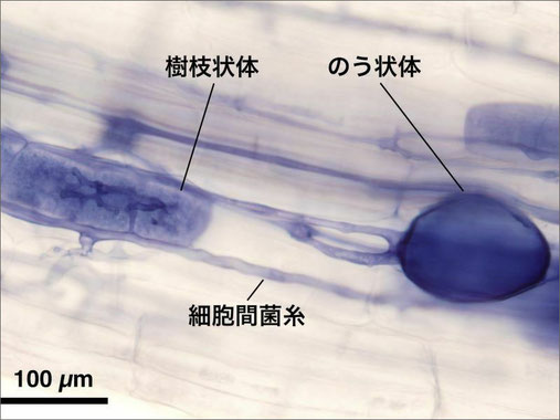 ダイズの根に感染している菌根菌（青い色素で染色）。菌糸が細かく分岐した樹枝状体と呼ばれる器官から植物に栄養分が渡される。のう状体は植物からもらった栄養分（脂質）を一時的に貯める器官。